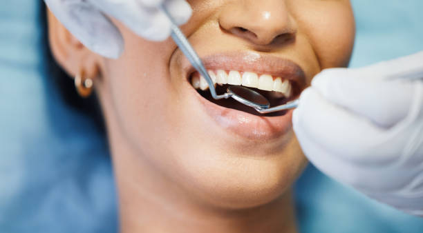 Best Emergency Tooth Extraction in Anderson Island, WA