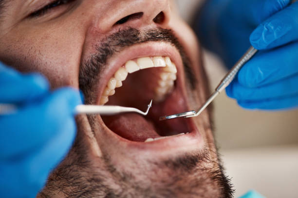 Best After-Hours Emergency Dentist in Anderson Island, WA