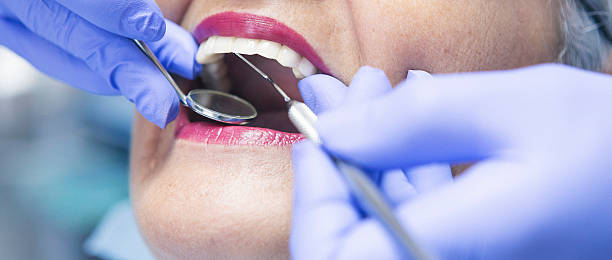 Best Emergency Treatment for Toothache in Anderson Island, WA